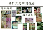 玉颜疤痕膏效果怎么样？能治疗老陈旧性疤痕吗？多少钱？微信号多少？ - 内蒙古新意网